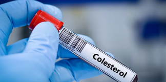 Colesterol: Três hábitos do cotidiano que podem piorar os níveis