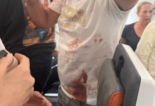 Piloto ferido em briga na cabine de aeronave com 160 a 180 passageiros